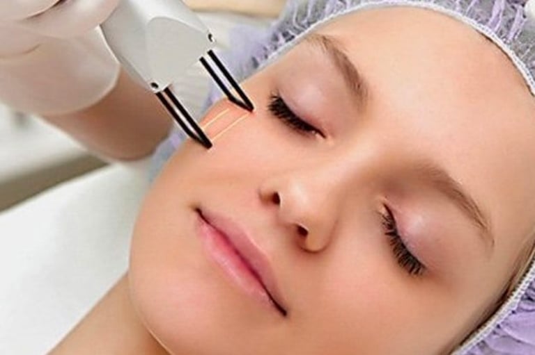 Resurfacing com Laser de CO₂